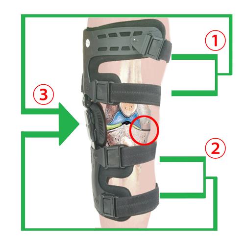 OA Unloader Knee Brace