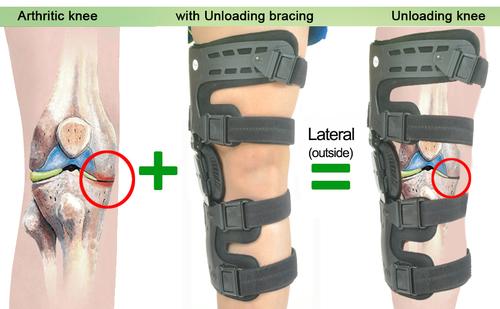 OA Unloader Knee Brace
